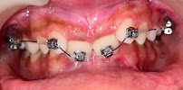 Brace Yourself Orthodontic