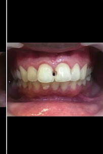 Brace Yourself Orthodontic