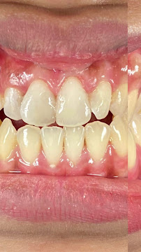 Calina Dental Care (Klinik Dokter Gigi, Praktek Dokter Gigi Denpasar) Clinic Dentist Bali