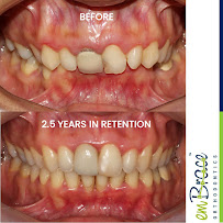 Embrace Orthodontics - Invisalign | Invisible Braces | Advanced Dentistry