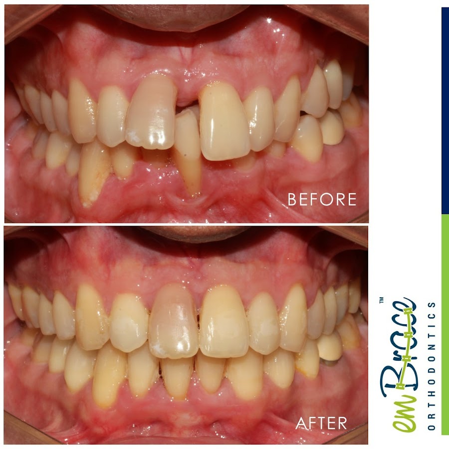 Embrace Orthodontics dental clinic in Mumbai