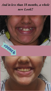 Smile Bracefully Orthodontic Center