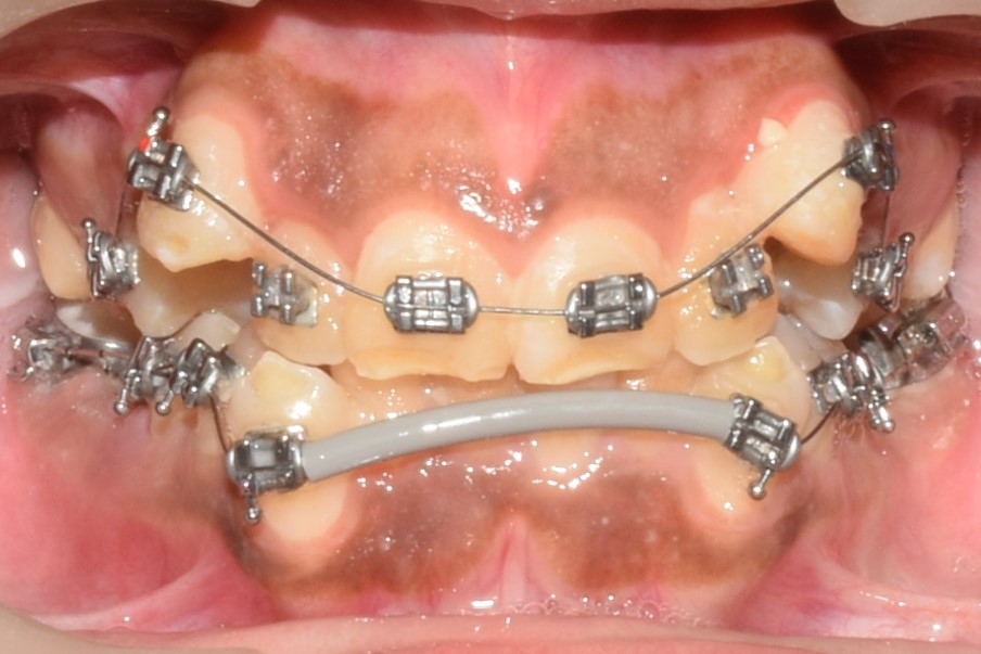 The Bombay Braces dental clinic