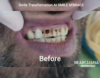 Smile M'Brace Complete Dental Care