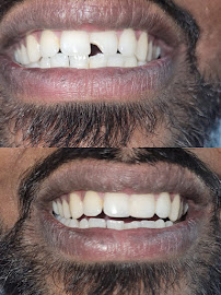 Smile M'Brace Complete Dental Care