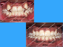 Arete Orthodontics