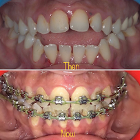 Arete Orthodontics