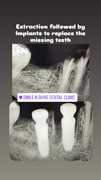 Dr Neha Dalmia's Smile N Shine Dental Clinic | Dentist in Borivali West, Mumbai