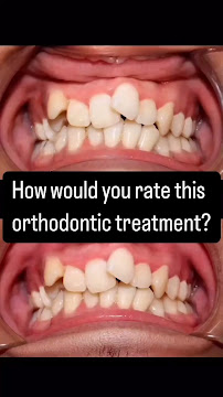 Braces and Beyond Multi Specialty Dental Care