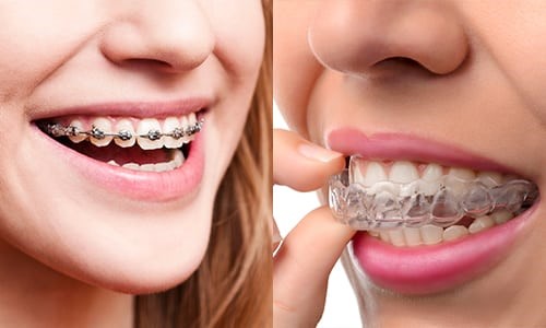 Embrace Smiles Dental and Orthodontic Clinic dental clinic