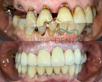 Bombay Dental Specialties