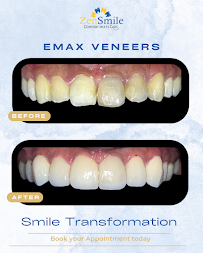 ZenSmile Dental Clinic