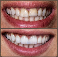 Dr. Rahul Jain's Swastik Dental Clinic & Implant centre