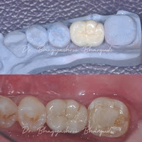 Dr. Bhagyashree’s Dental Clinic and Implant Centre