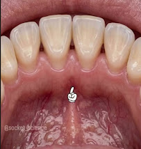Dental implants and Root canal specialist