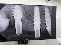 URBAN SMILES DENTAL CLINIC AND IMPLANT CENTER
