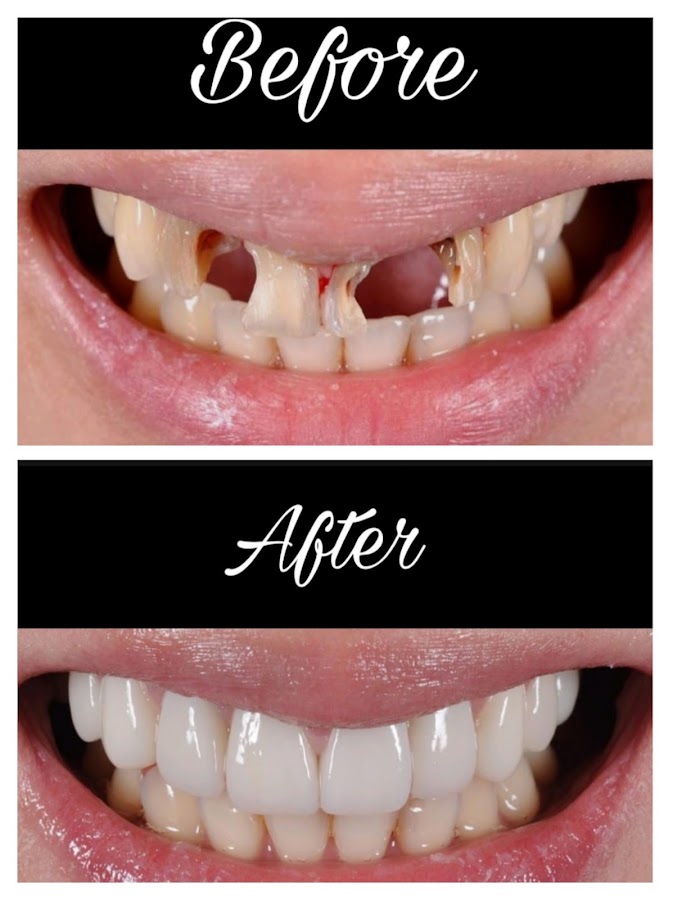 Dr Patel Dental Care dental clinic in Mumbai