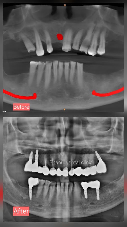 Bhanu Dental Clinic and Implant Centre dental clinic