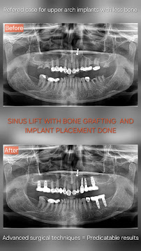 BHANU DENTAL CLINIC & IMPLANT CENTRE( Dr Vasant Bhanushali )