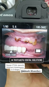 Toothastu Dental Clinic | Dental Implants, Braces, Root Canal Treatment, in Colaba, Mumbai