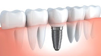 Denite Dental Care
