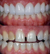 Denite Dental Care
