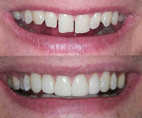 Dr. Manali Mathuria Dental Care