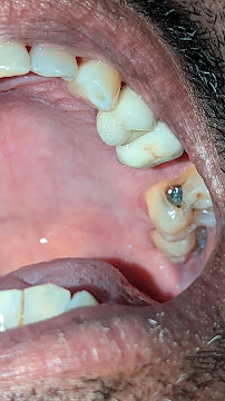 Expressions Maxillofacial Surgery & Dentirsty | Dr Adil & Dr Fatema Gandevivala