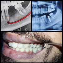 Dr. Megha shah’s maxillofacial center