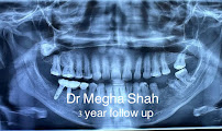 Dr. Megha shah’s maxillofacial center