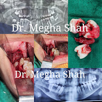 Dr. Megha shah’s maxillofacial center