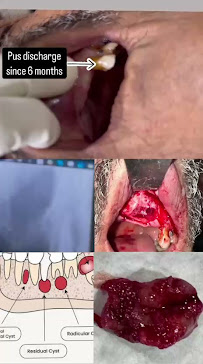 Dr. Megha shah’s maxillofacial center