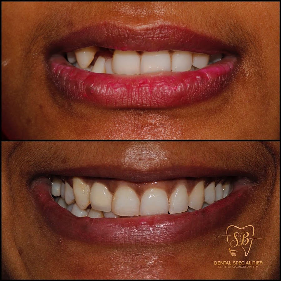 S&B Dental Specialities Centre Of Advanced Dentistry dental clinic in Mumbai