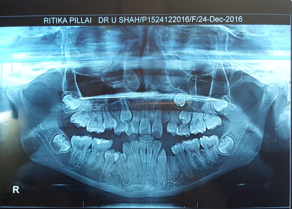 Zenith Dental Solutions dental clinic in Mumbai