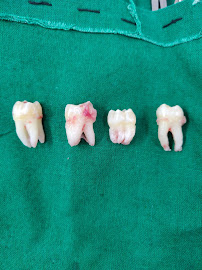Dr. Balse's Centre for Oral & Maxillofacial Surgery