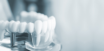 Dr. Prit Shah's Dynamic Dentocare - Oral & Maxillofacial Surgeon in Tardeo | Dental Implants, Root Canal | Dentist in Tardeo