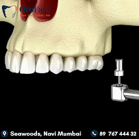OroFace® Dental Clinic Seawoods, Navi Mumbai
