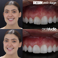 OralStudio- Smile Makeover Medellin