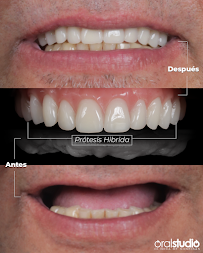 OralStudio- Smile Makeover Medellin