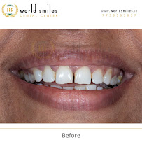 World Smiles dental center