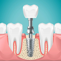 Specialist Dental Centre (SINCE 1983)