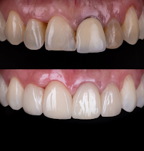 Premium Dental Medellín