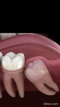 MAHAVIR Dental Care & Implant Centre