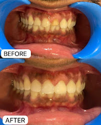 KASHMIRA'S DENTAL CARE