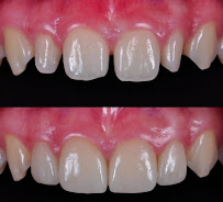 Dr. Bagul's smile dental care