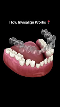 Shri AADINATH Dental care:- Root canals | dental implants | Braces and Aligners |advanced dental care in borivali East