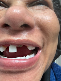Clínica Viena / Veneers Medellín