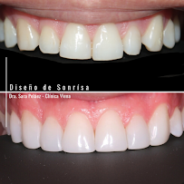 Clínica Viena / Veneers Medellín