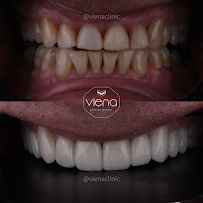 Clínica Viena / Veneers Medellín