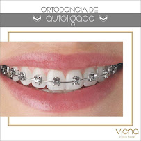 Clínica Viena / Veneers Medellín